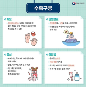 대구시, 손·발·입안 수포성 발진 일으키는 ‘수족구병’ 주의하세요